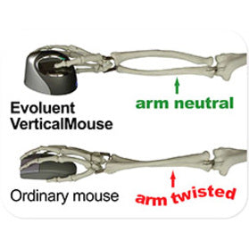 Evoluent VM4R VerticalMouse 4 Right Mouse, Ergonomic Optical Scroll Wheel, 2600 dpi, USB 2.0