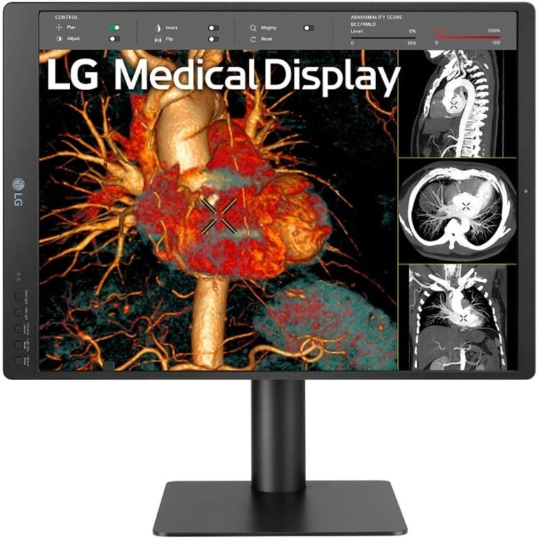 LG 21HQ513D-B 21.3" QXGA LCD Monitor, 3MP IPS Diagnostic Monitor, 1100 Nit Brightness, 72% NTSC Color Gamut